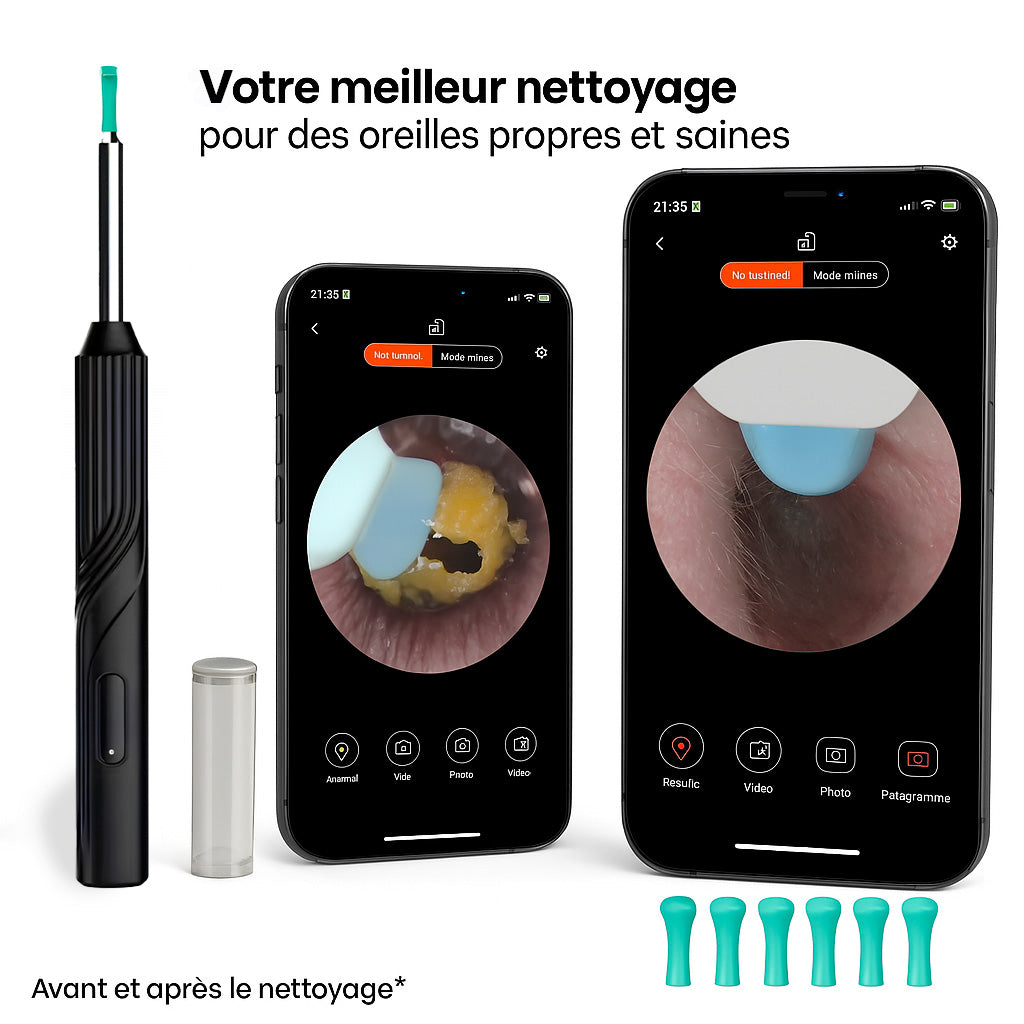 MyEarsPro™ - Complete 7 in 1 Kit