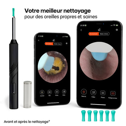 MyEarsPro™ - Complete 7 in 1 Kit